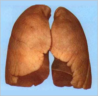 Як очитити легені